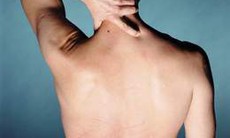 Không nên tự ý sử dụng thuốc giãn cơ
